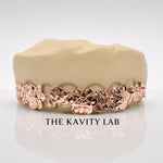 Custom 8pcs 3D Floral Engraved Grillz: 925 Sterling Silver (Free Mold Kit)