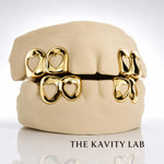 Custom 4pc Open Hearts GRILLZ: 925 Sterling Silver (Free Mold Kit)