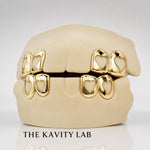 Custom 4pc Open Hearts GRILLZ: 925 Sterling Silver (Free Mold Kit)