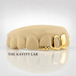 Custom 3pcs Diamond Cuts & Open-Face Grillz : 925 Sterling Silver (Free Mold Kit)