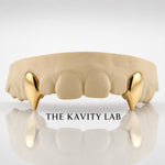 Custom 2pcs Solid & Extended Fangs Grillz: 925 Sterling Silver (Free Mold Kit)