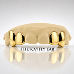 Custom 4pcs Solid Class: 925 Sterling Silver (Free Mold Kit)