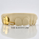 Custom 3pcs Plain Jane x Moissanite Tip Grillz: 925 Sterling Silver (Free Mold Kit)
