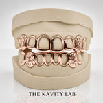 Custom 8pcs Diamond Cut x Open Face Grillz: 925 Sterling Silver (Free Mold Kit)