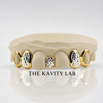 Custom 6pcs Gap Filler x Diamond Cuts Grillz: 925 Sterling Silver (Free Mold Kit)
