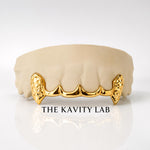 Custom 6pc Curved Front Bar and Diamond Cut Grillz: 925 Sterling Silver (Free Mold Kit)