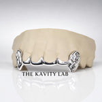 Custom 6pc Curved Front Bar and Diamond Cut Grillz: 925 Sterling Silver (Free Mold Kit)