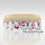 Custom 8pcs Red and White Marble Enamel Grillz: 925 Sterling Silver (Free Mold Kit)