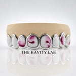 Custom 8pcs Red and White Marble Enamel Grillz: 925 Sterling Silver (Free Mold Kit)