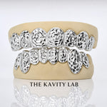 Custom Roses Cuts x Dust Grillz: 925 Sterling Silver Rose Gold Plated (Free Mold Kit)