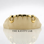 Custom 6pc Curved Front Bar Style Grillz: 925 Sterling Silver (Free Mold Kit)