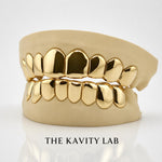 Custom Plain Solid with Permanent Cuts Grillz: 925 Sterling Silver (Free Mold Kit)