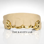 Custom 6pc Curved Front Bar and Diamond Cut Grillz: 925 Sterling Silver (Free Mold Kit)