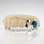 Custom 2pcs Open Heart x Opal Stone Grillz: 925 Sterling Silver (Free Mold Kit)