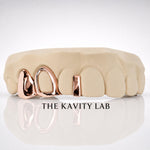 Custom 3pcs Open Face & Gap Filler Grillz: 925 Sterling Silver (Free Mold Kit)