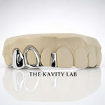 Custom 3pcs Open Face & Gap Filler Grillz: 925 Sterling Silver (Free Mold Kit)