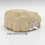 Custom 2pc Open Heart with Open Face Grillz: 925 Sterling Silver (Free Mold Kit)