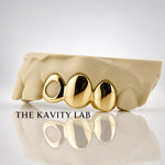 Custom 3pc Open Face x Solid Caps Grillz: 925 Sterling Silver (Free Mold Kit)