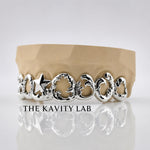 Custom 8pcs Intricate Baroque Royal Design Grillz: 925 Sterling Silver (Free Mold Kit)