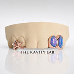 Custom 6pc Blue Opals with Big 3D Stars GRILLZ: 925 Sterling Silver (Free Mold Kit)