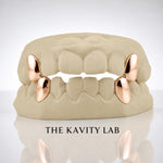 Custom 2pcs Solid Fangs: 925 Sterling Silver (Free Mold Kit)