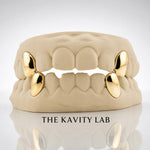 Custom 2pcs Solid Fangs: 925 Sterling Silver (Free Mold Kit)