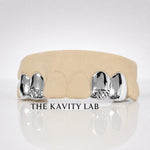 Custom 4pcs White Diamond Cuts Grillz: 925 Sterling Silver (Free Mold Kit)