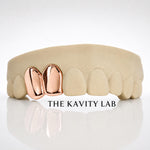 Custom 2pc Plain Jane Soild Grillz: 925 Sterling Silver (Free Mold Kit)