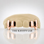 Custom 4pcs Solid with Small Fangs Grillz: 925 Sterling Silver (Free Mold Kit)