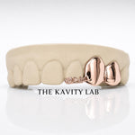 Custom 3pc Rose Detail x Solid Caps Grillz: 925 Sterling Silver (Free Mold Kit)