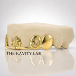 Custom Fit Starburst Cuts Grillz: 925 Sterling Silver (Free Mold Kit)