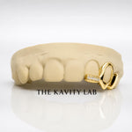 Custom 3pcs Open Face and Moissanite Tip Grillz: 925 Sterling Silver (Free Mold Kit)