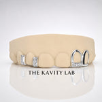 Custom 6pc with Moissanite Gap Filler: 925 Sterling Silver (Free Mold Kit)