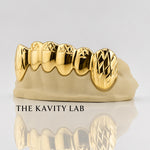 Custom 6pcs Diamond Cuts Grillz: 925 Sterling Silver (Free Mold Kit)