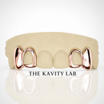 Custom 4pcs Solid Class with Open Face Grillz: 925 Sterling Silver (Free Mold )