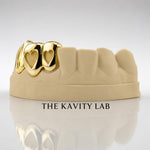 Custom 3pcs Open Hearts x Diamond Cut Grillz: 925 Sterling Silver (Free Mold Kit)