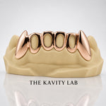 Custom 6pcs Open Face with Extended Fangs Grillz: 925 Sterling Silver (Free Mold Kits)