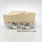 Custom 8pcs 3D Floral Engraved Grillz: 925 Sterling Silver (Free Mold Kit)