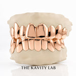 Custom Plain Solid with Permanent Cuts Grillz: 925 Sterling Silver (Free Mold Kit)