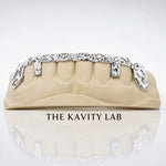Custom 8pcs Gap Cover with Diamond Cuts Grillz: 925 Sterling Silver (Free Mold Kit)