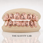 Custom 8pcs Starburst Cuts and Dust Grillz: 925 Sterling Silver (Free Mold Kit)