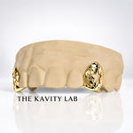 Custom Fit 2pc Open Stars with Cuts Grillz: 925 Sterling Silver (Free Mold Kit)