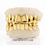 Custom Plain Solid with Permanent Cuts Grillz: 925 Sterling Silver (Free Mold Kit)
