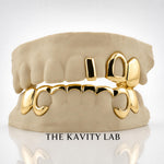 Custom 3pcs Gap and 8pcs Front Bar Grillz: 925 Sterling Silver (Free Mold Kit)