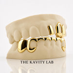 Custom 3pcs Gap and 8pcs Front Bar Grillz: 925 Sterling Silver (Free Mold Kit)